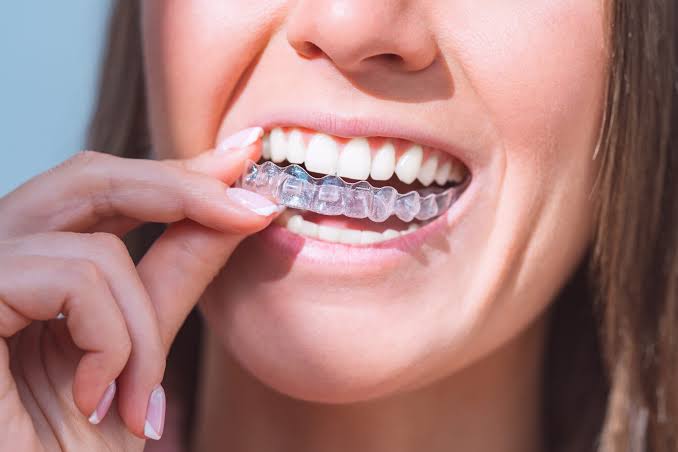 How-To Guide: Master Your Dental Care At Home